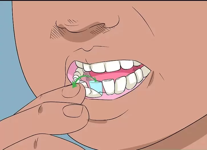 بهترین روش برای درمان دندان شیری